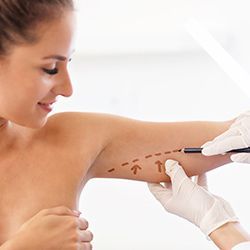 Arm Contouring Arm Contouring image
